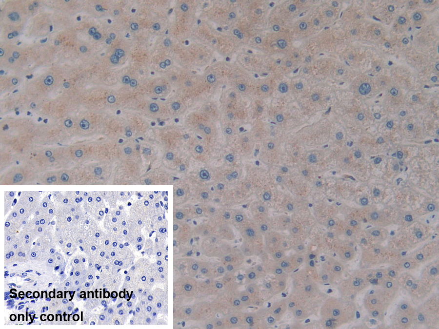 Polyclonal Antibody to Sp140 Nuclear Body Protein (SP140)