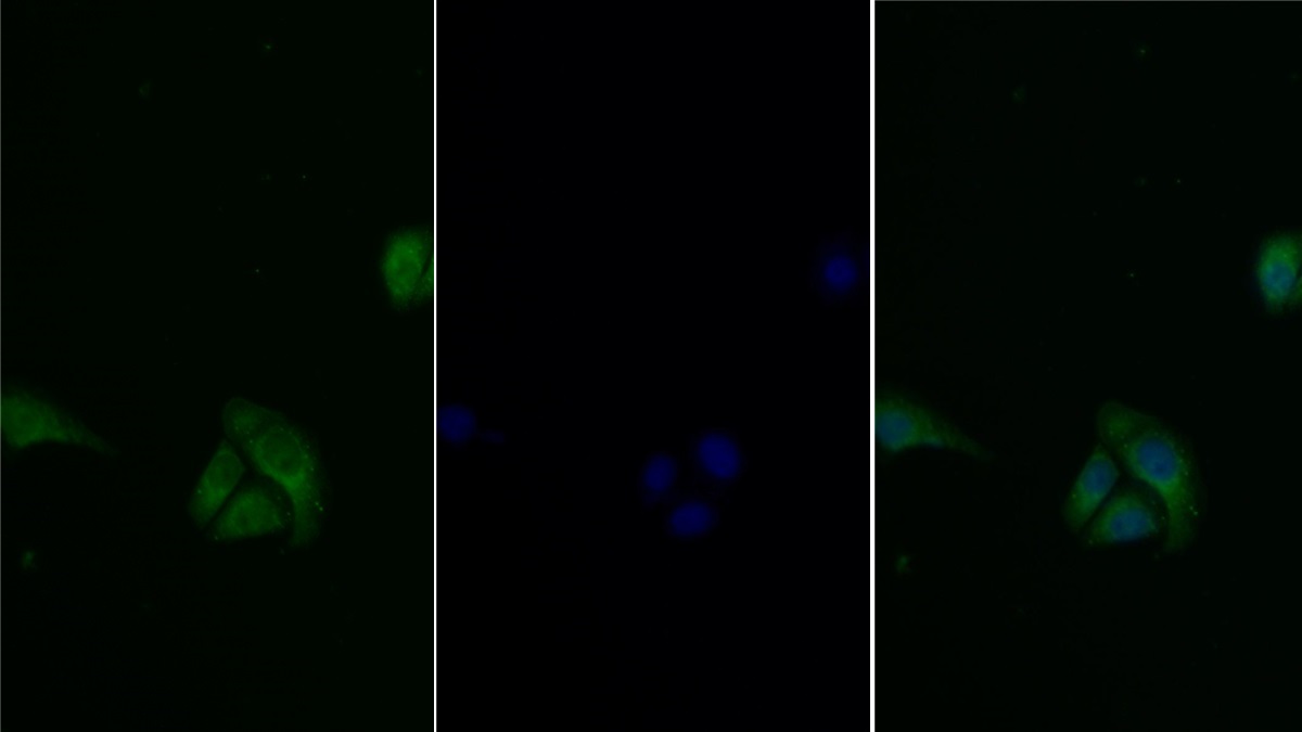 Polyclonal Antibody to Autophagy Related Protein 16 Like Protein 1 (ATG16L1)