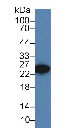 Polyclonal Antibody to Dickkopf Like Protein 1 (DKKL1)