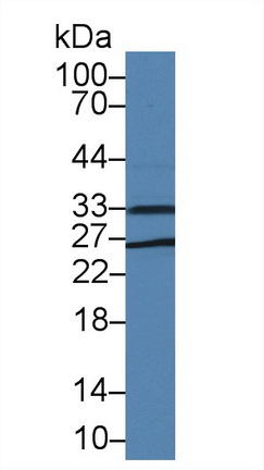 Polyclonal Antibody to Dickkopf Like Protein 1 (DKKL1)