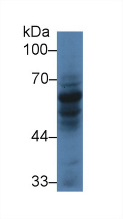 Polyclonal Antibody to Caspase Recruitment Domain Family, Member 9 (CARD9)