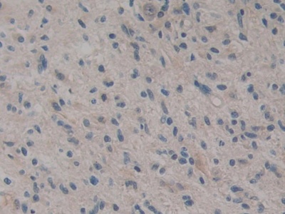 Polyclonal Antibody to Caspase Recruitment Domain Family, Member 9 (CARD9)