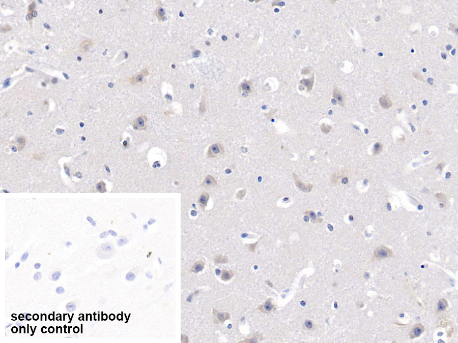 Polyclonal Antibody to Myosin Heavy Chain 7B, Cardiac Muscle Beta (MYH7B)