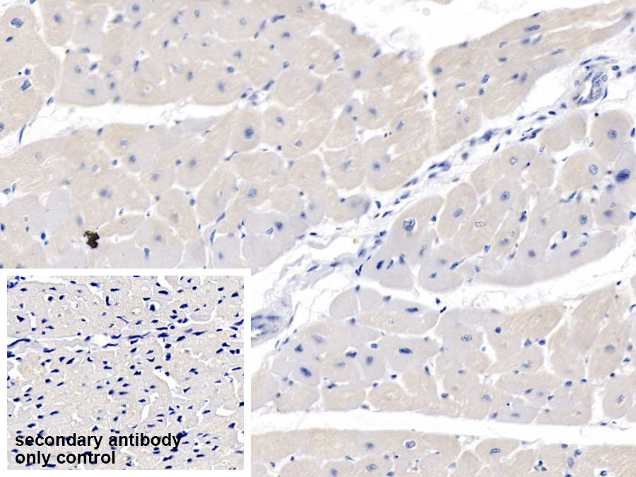 Polyclonal Antibody to Myosin Heavy Chain 7B, Cardiac Muscle Beta (MYH7B)