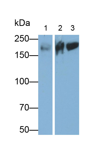 Polyclonal Antibody to Myosin Heavy Chain 7B, Cardiac Muscle Beta (MYH7B)