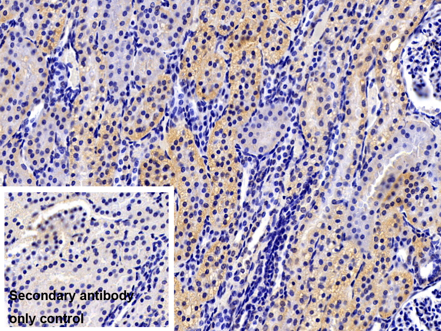 Polyclonal Antibody to Retinol Binding Protein 5, Cellular (RBP5)