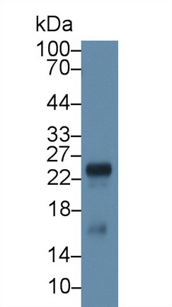 Polyclonal Antibody to Retinol Binding Protein 5, Cellular (RBP5)