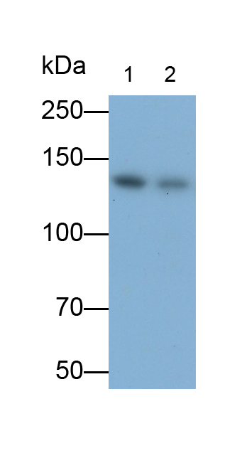 Polyclonal Antibody to PR Domain Containing Protein 16 (PRDM16)