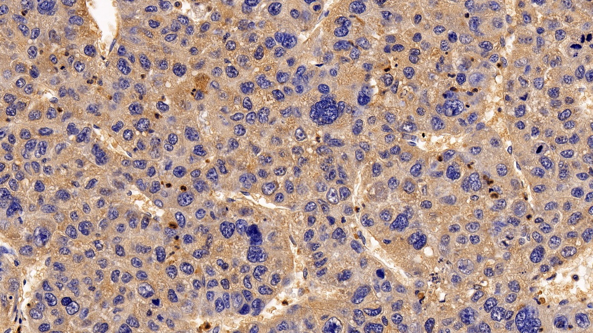 Polyclonal Antibody to Regulator Of G Protein Signaling 19 (RGS19)