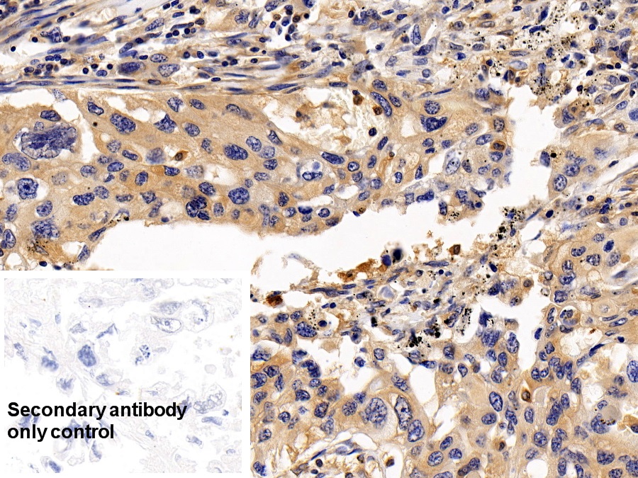 Polyclonal Antibody to Regulator Of G Protein Signaling 19 (RGS19)