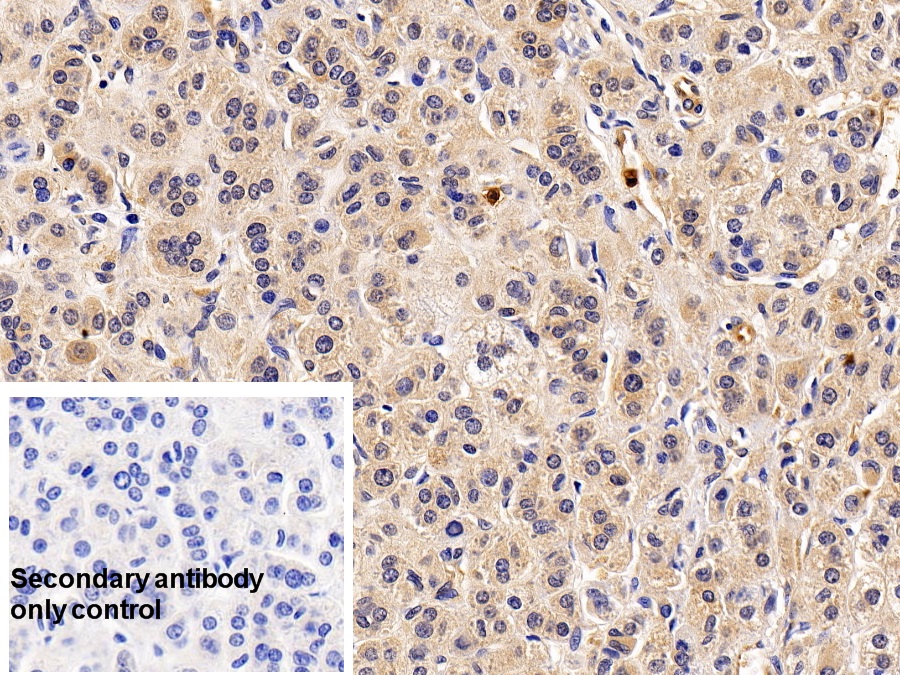 Polyclonal Antibody to Regulator Of G Protein Signaling 19 (RGS19)