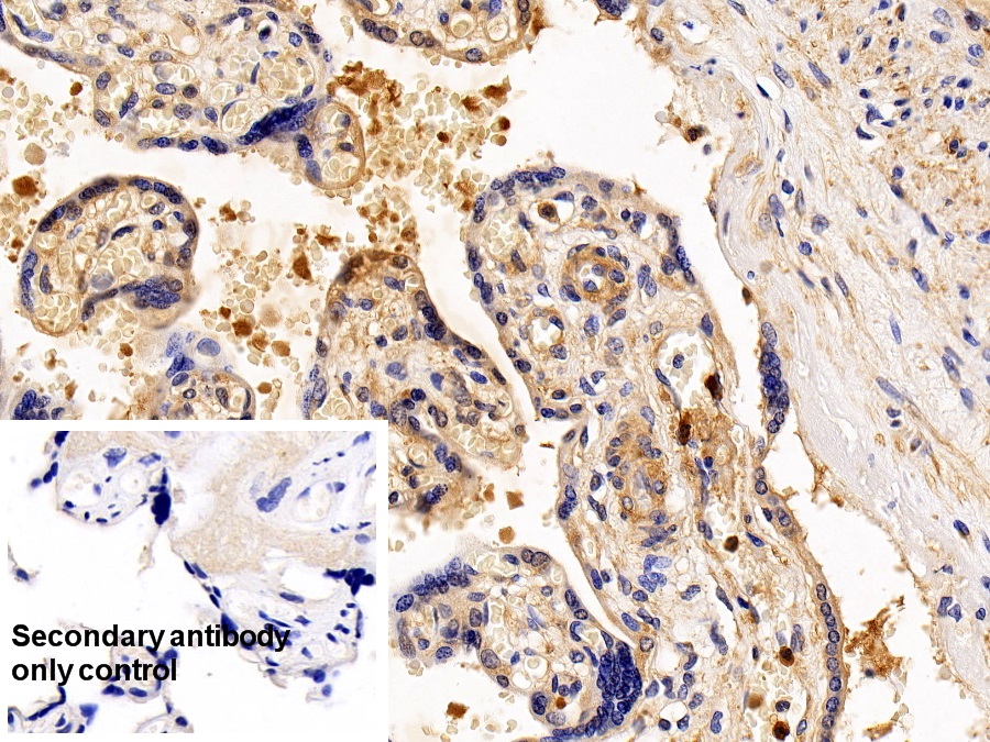 Polyclonal Antibody to Regulator Of G Protein Signaling 19 (RGS19)