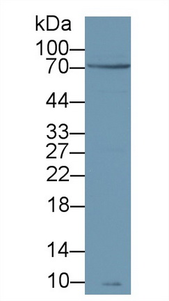 Polyclonal Antibody to Zeta Chain Associated Protein Kinase 70kDa (zAP70)