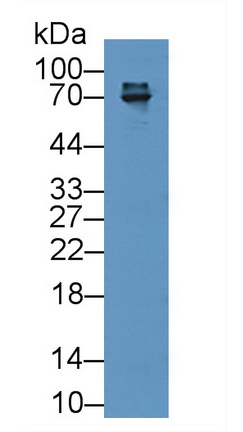 Polyclonal Antibody to Zeta Chain Associated Protein Kinase 70kDa (zAP70)