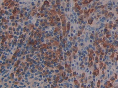 Polyclonal Antibody to Linker For Activation Of T-Cells Family, Member 2 (LAT2)