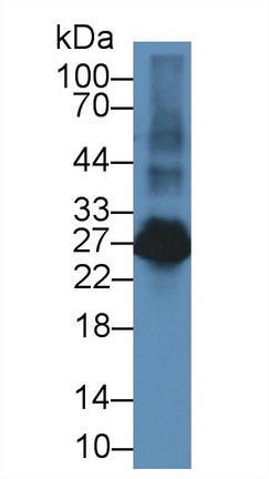 Polyclonal Antibody to Linker For Activation Of T-Cells Family, Member 2 (LAT2)