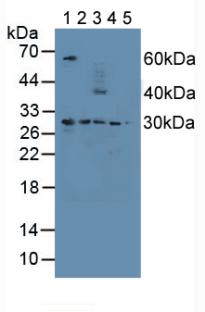 Polyclonal Antibody to Proteasome 26S Subunit, Non ATPase 9 (PSMD9)