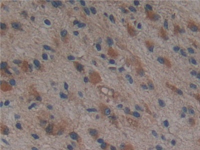 Polyclonal Antibody to Proteasome 26S Subunit, Non ATPase 9 (PSMD9)