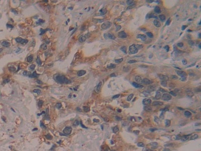 Polyclonal Antibody to Proteasome 26S Subunit, Non ATPase 13 (PSMD13)