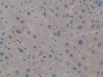 Polyclonal Antibody to Pim-2 Oncogene (PIM2)