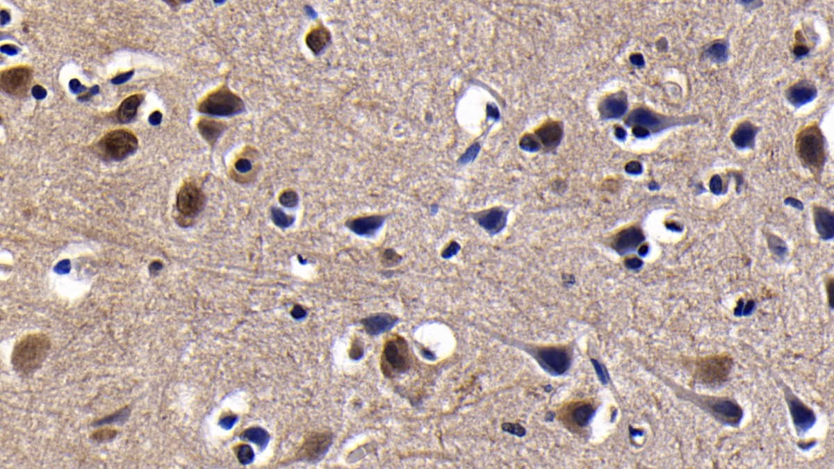 Polyclonal Antibody to Poly ADP Ribose Glycohydrolase (PARG)