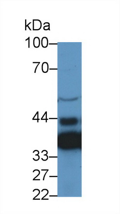 Polyclonal Antibody to LIM And Senescent Cell Antigen Like Domains Protein 1 (LIMS1)