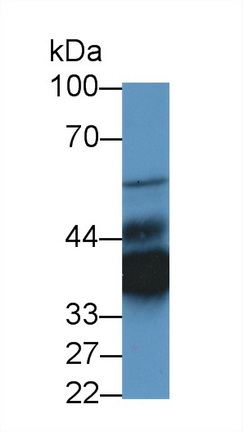 Polyclonal Antibody to LIM And Senescent Cell Antigen Like Domains Protein 1 (LIMS1)