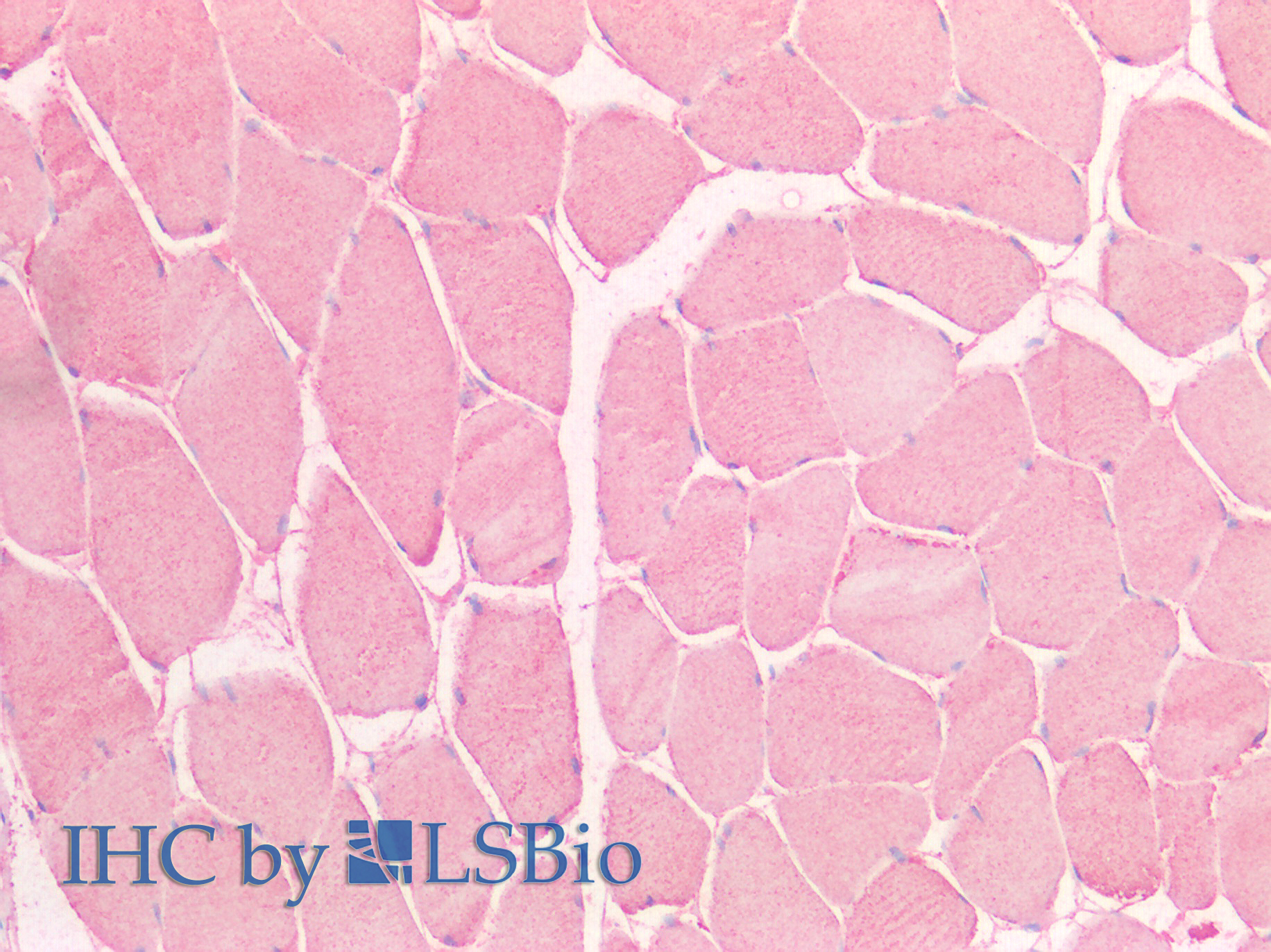 Polyclonal Antibody to LIM And Senescent Cell Antigen Like Domains Protein 1 (LIMS1)