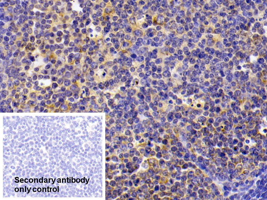 Polyclonal Antibody to LIM And Senescent Cell Antigen Like Domains Protein 1 (LIMS1)