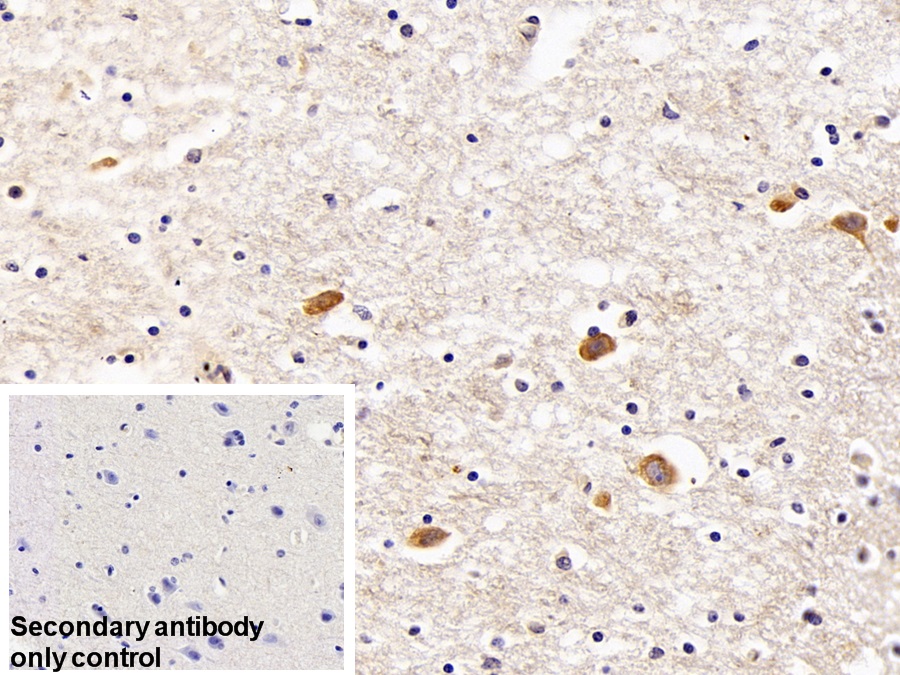 Polyclonal Antibody to Laminin Receptor 1 (LAMR1)