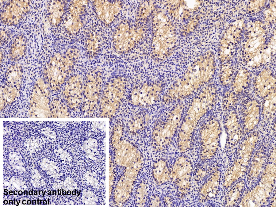 Polyclonal Antibody to Laminin Receptor 1 (LAMR1)