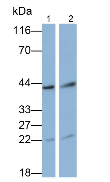 Polyclonal Antibody to Laminin Receptor 1 (LAMR1)