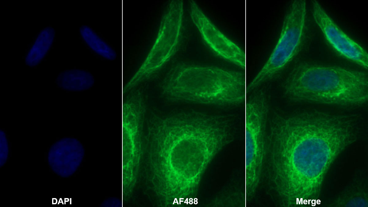 Polyclonal Antibody to Keratin 81 (KRT81)