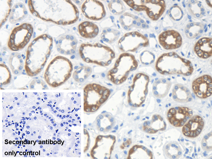 Polyclonal Antibody to Keratin 33A (KRT33A)