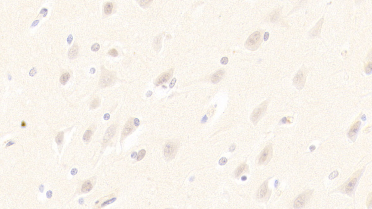 Polyclonal Antibody to Keratin 23 (KRT23)