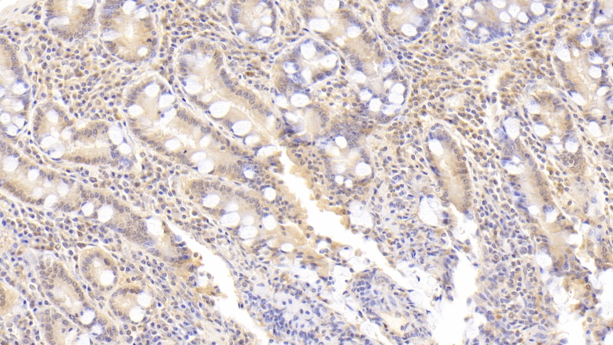 Polyclonal Antibody to IK Cytokine, Down Regulator Of HLA II (IK)