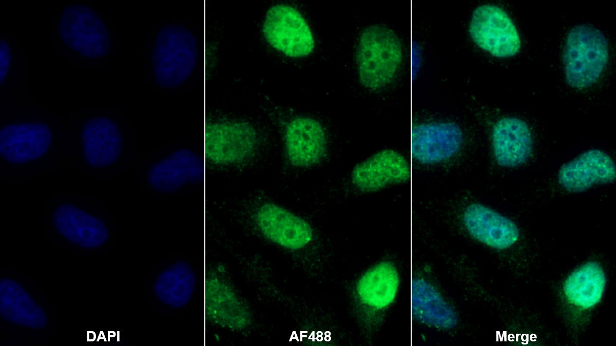 Polyclonal Antibody to H2A Histone Family, Member X (H2AFX)