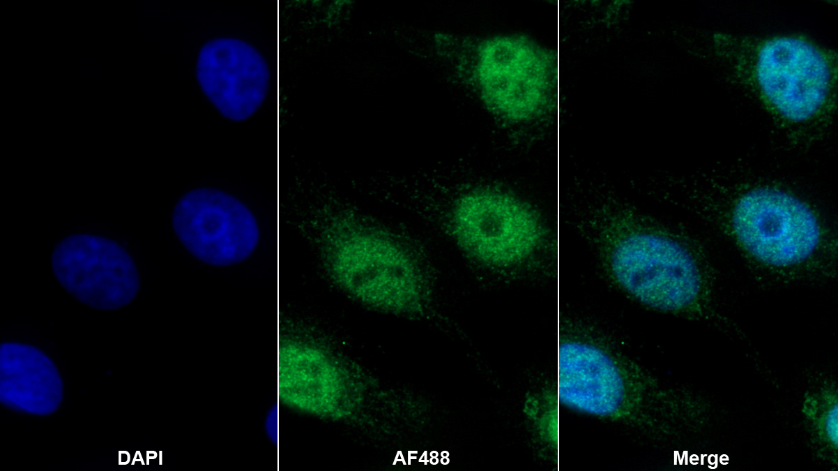 Polyclonal Antibody to Histone Cluster 2, H2be (HIST2H2BE)