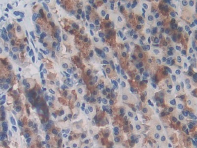 Polyclonal Antibody to Leucine Rich Repeat Containing Protein 32 (LRRC32)