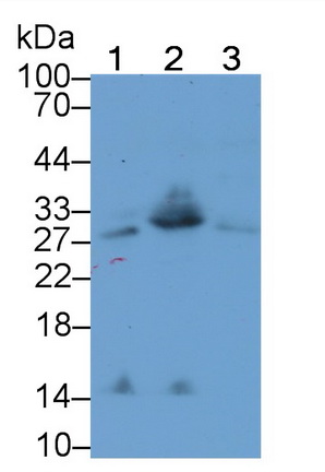 Polyclonal Antibody to Cluster Of Differentiation 8b (CD8b)