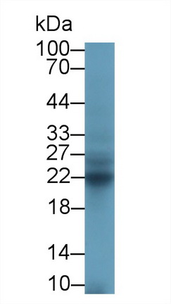 Polyclonal Antibody to Cluster Of Differentiation 8b (CD8b)