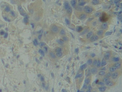 Polyclonal Antibody to BMX Non Receptor Tyrosine Kinase (BMX)