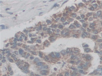 Polyclonal Antibody to Coupling Factor 6 (CF6)