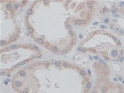 Polyclonal Antibody to Coupling Factor 6 (CF6)