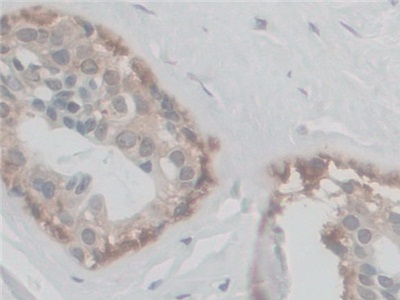 Polyclonal Antibody to Coupling Factor 6 (CF6)