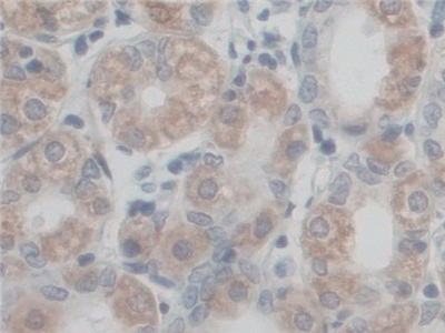 Polyclonal Antibody to Coupling Factor 6 (CF6)