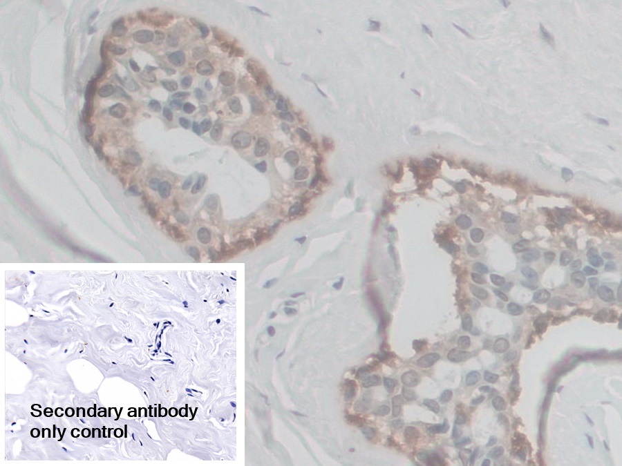 Polyclonal Antibody to Coupling Factor 6 (CF6)