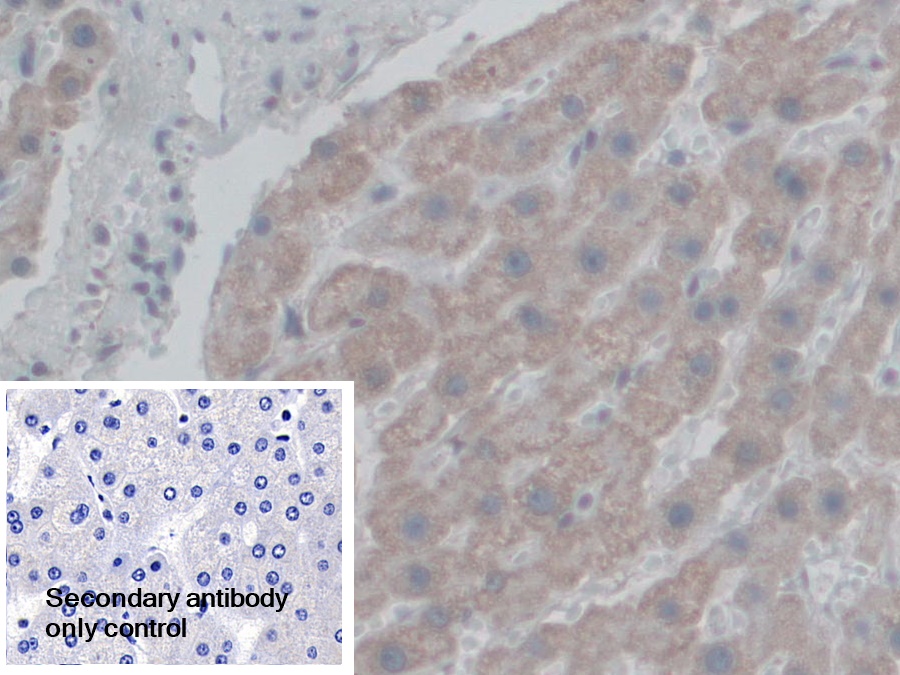 Polyclonal Antibody to Coupling Factor 6 (CF6)