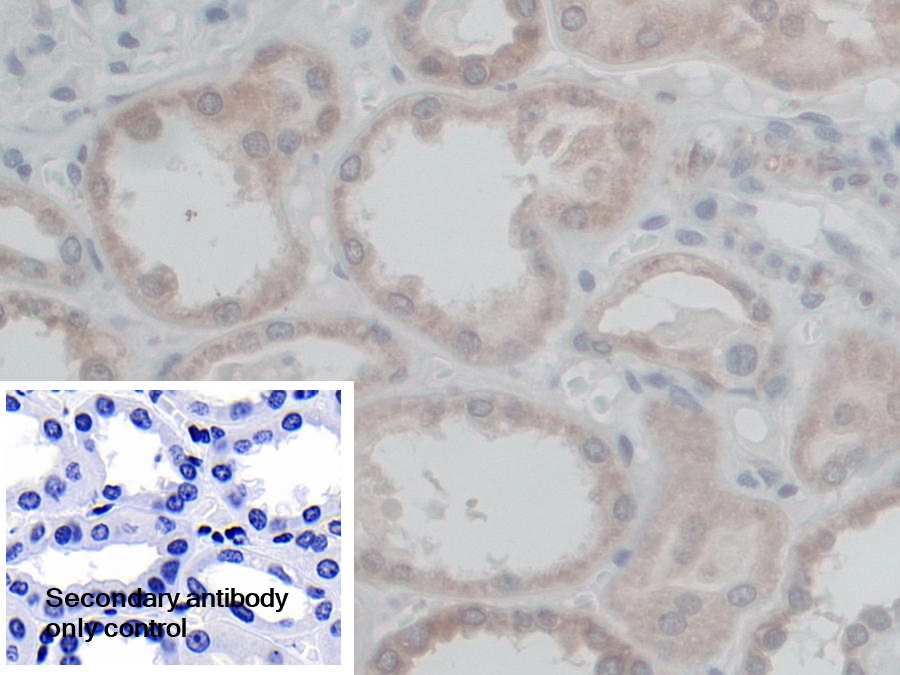 Polyclonal Antibody to Coupling Factor 6 (CF6)