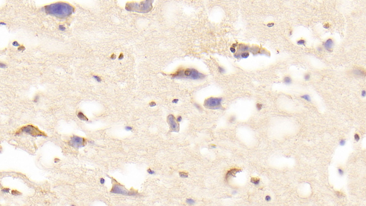 Polyclonal Antibody to A Disintegrin And Metalloprotease 20 (ADAM20)